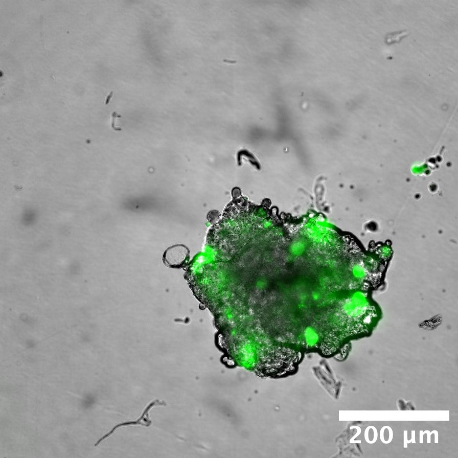 FK 866 treatment spheroid day